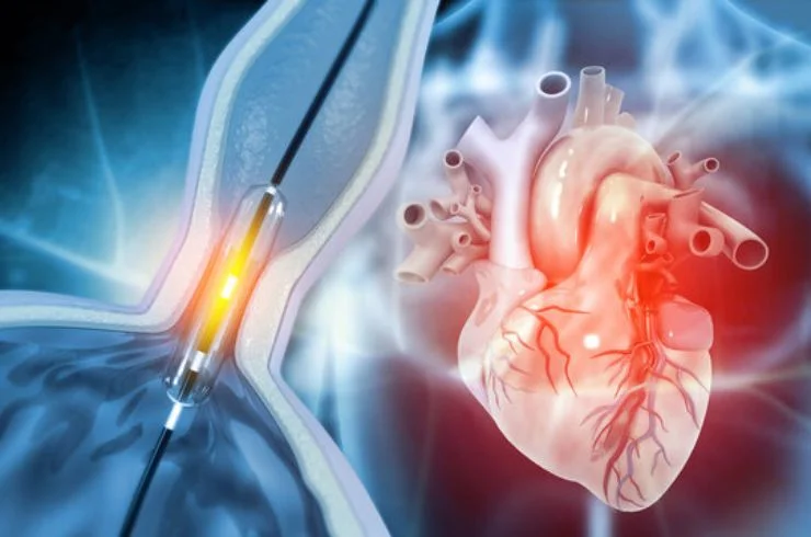 Coronary Angiography